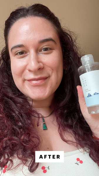 Abelman after applying the Round Lab 1025 Dokdo Toner